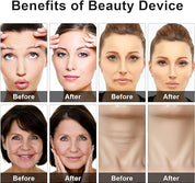 Eye Beauty Massage Device - Reduces Puffiness & Fatigue