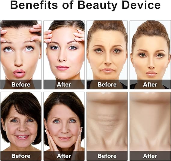 Eye Beauty Massage Device - Reduces Puffiness & Fatigue