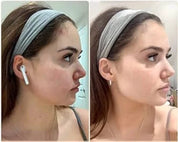 EMS Face Massager - Lifting & Contouring Tool