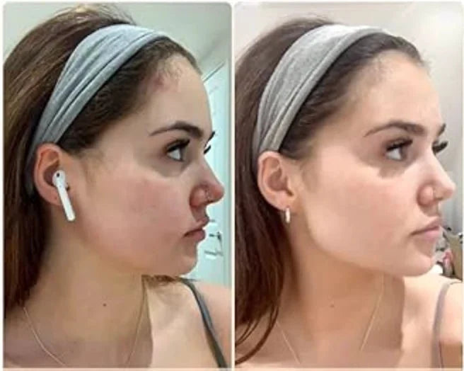 EMS Face Massager - Lifting & Contouring Tool