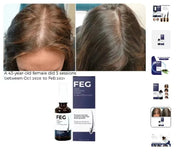 Daily Hair Growth Spray - Nourishes Scalp & Roots
