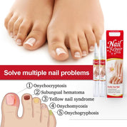 Nail Repair & Care Pen - Precision Applicator