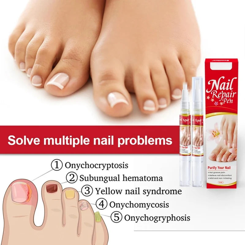 Nail Repair & Care Pen - Precision Applicator