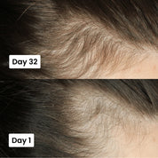 Scalp Nourishing Hair Growth Serum