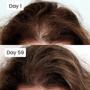 Scalp Nourishing Hair Growth Serum